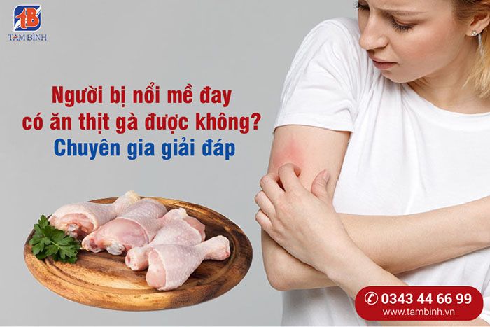 ăn gà bị ngứa: nguyên nhân, triệu chứng và cách điều trị hiệu quả