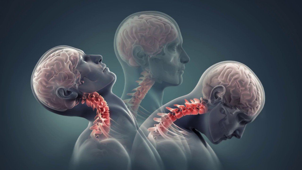 Bệnh thoái hóa tiểu não: Nguyên nhân, triệu chứng và cách điều trị