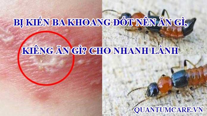 Bí quyết ăn uống cho người bị kiến ba khoang cắn