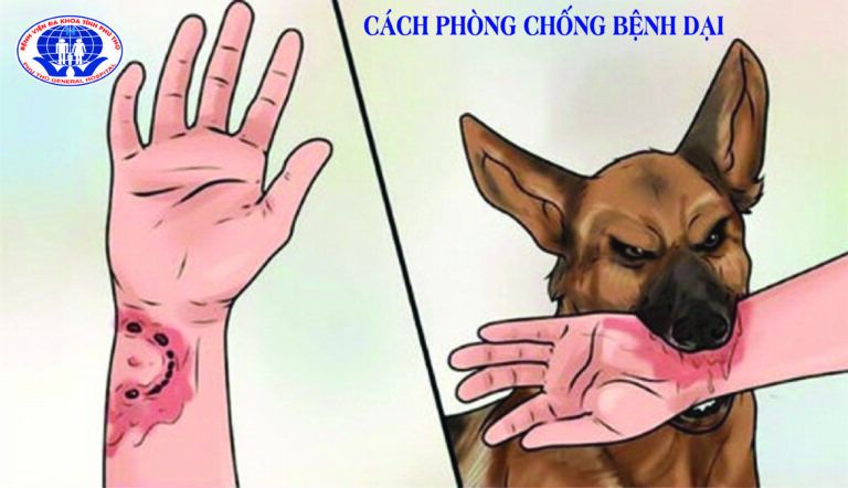 Biểu hiện của bệnh dại: Những triệu chứng và cách phòng chống