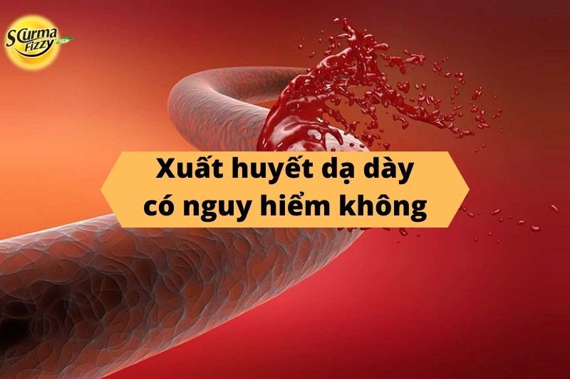 Biểu hiện xuất huyết dạ dày: Nguyên nhân, triệu chứng và cách điều trị