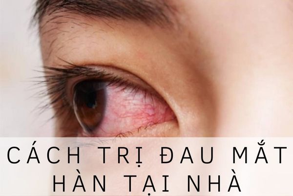 Cách chữa đau mắt hàn nhanh nhất - Những phương pháp hiệu quả