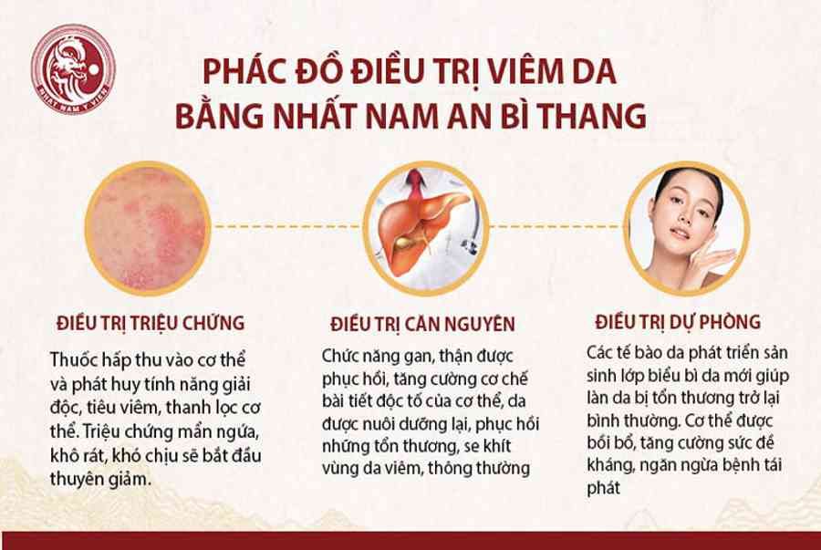 Cách chữa viêm da dị ứng tại nhà hiệu quả và dễ dàng