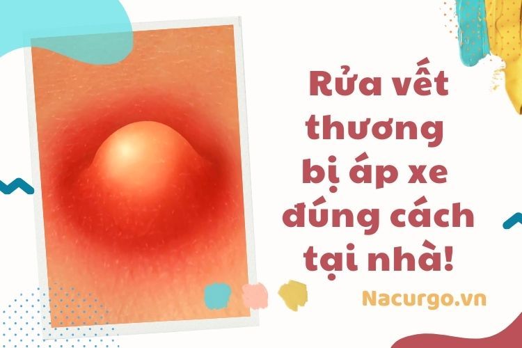 Cách rửa vết thương áp xe - Hướng dẫn chi tiết từ A đến Z