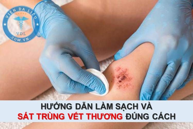 Cách vệ sinh vết thương đúng cách và hiệu quả