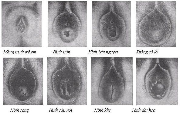 Cấu tạo của bím - Tìm hiểu chi tiết về cấu trúc bên trong của bím