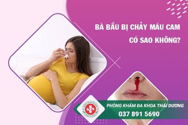 Chảy máu cam có sao không? Tất tần tật thông tin bạn cần biết