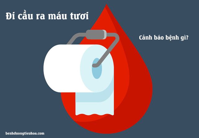 Đi cầu ra máu là bệnh gì? Tất tần tật thông tin mà bạn cần biết