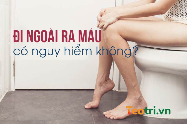 Đi ngoài ra máu có nguy hiểm không? Tất cả những gì bạn cần biết