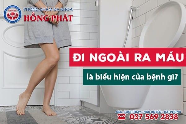 Đi vệ sinh ra máu bệnh gì? Nguyên nhân và các cách điều trị hiệu quả