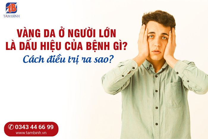 Điều Trị Tăng Bilirubin Máu ở Người Lớn: Các Phương Pháp Hiệu Quả