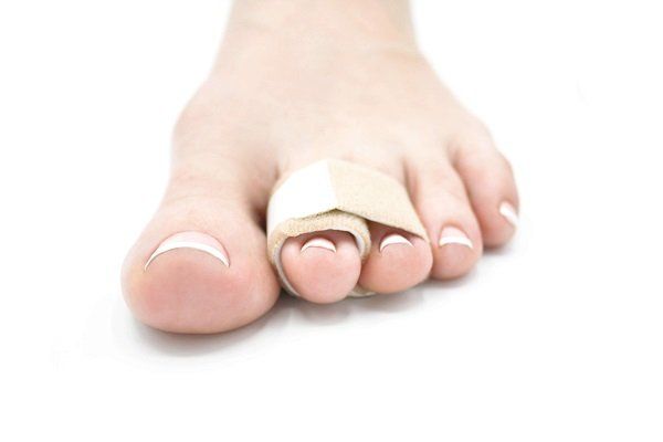 Gãy xương ngón chân bao lâu thì lành? - Thông tin chính xác và chi tiết từ chuyên gia