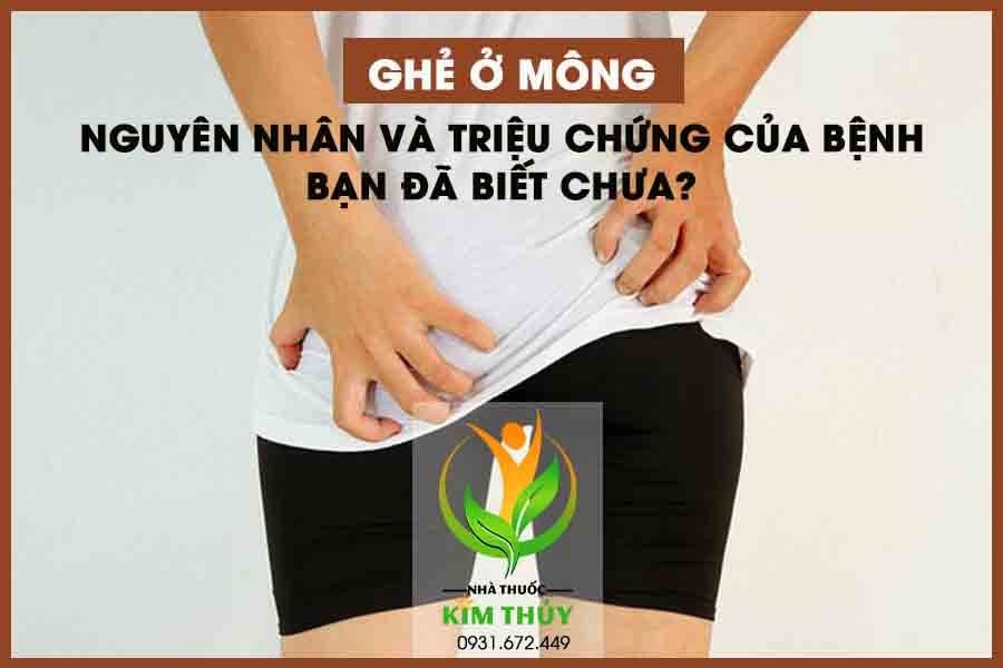 Ghẻ ở mông - Nguyên nhân, triệu chứng và cách điều trị