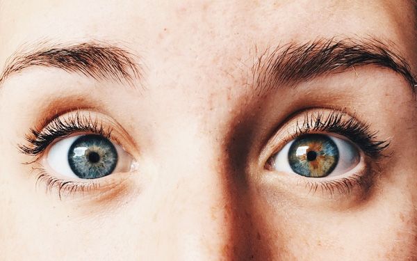 Heterochromia là gì? Tìm hiểu về hiện tượng mắt đồng tố và mắt khác tố