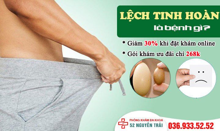 Lệch tinh hoàn - Nguyên nhân, triệu chứng và phương pháp điều trị hiệu quả