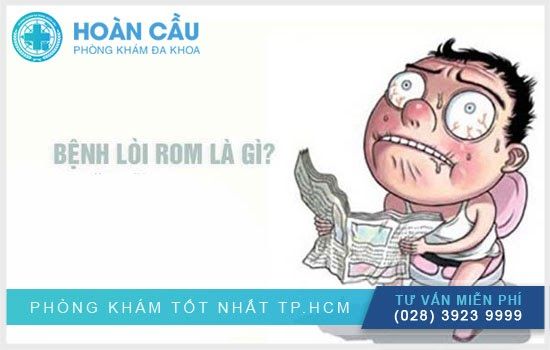 Tìm hiểu về lòi con trê - loài cá đặc biệt của nước ta