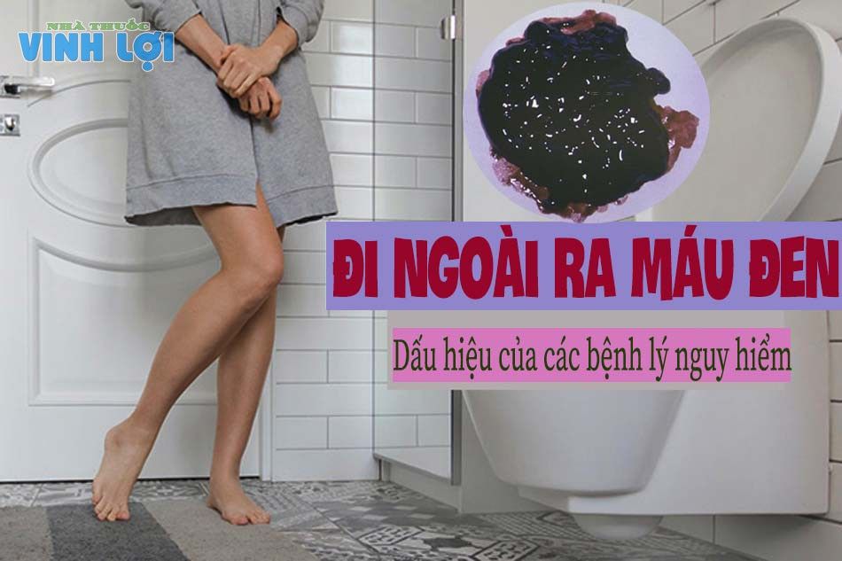 Mang thai đi ngoài màu đen - Nguyên nhân, triệu chứng và cách điều trị