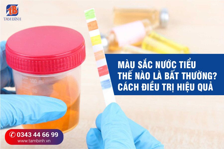 Tìm hiểu về màu nước tiểu: Ảnh hưởng đến sức khỏe và cách điều trị