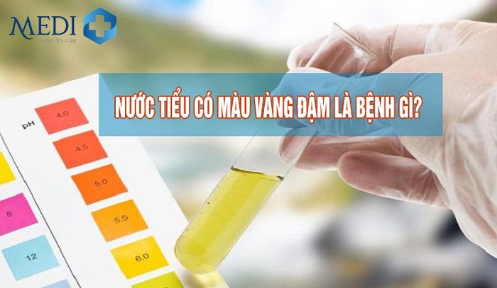 Màu vàng đậm - tìm hiểu sức hút và ý nghĩa của một gam màu đặc biệt