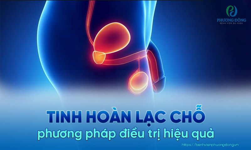 Mổ tinh hoàn lạc chỗ: Nguyên nhân, triệu chứng và phương pháp điều trị hiệu quả