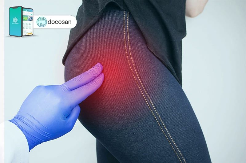 Tất tần tật thông tin về mông bị sưng đau bạn cần biết