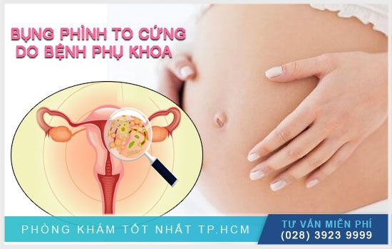 Tìm hiểu nguyên nhân bụng phình to - Thông tin chi tiết và cách giảm bụng