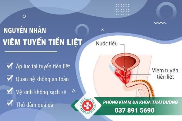 Tìm hiểu về nguyên nhân viêm tuyến tiền liệt - Những nguyên nhân cần biết