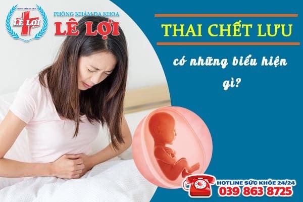 Những biểu hiện thai lưu và cách nhận biết sớm