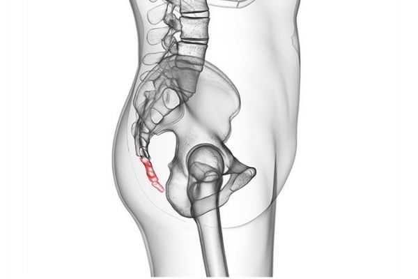 Tìm hiểu về nổi cục ở xương cụt: Nguyên nhân, triệu chứng và cách khắc phục