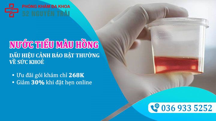 Tìm hiểu về nước tiểu màu hồng nhạt: Nguyên nhân và liệu có nguy hiểm không?