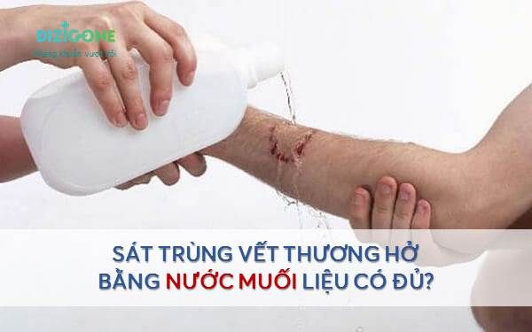 Tất tần tật thông tin về cách rửa vết thương bằng nước muối