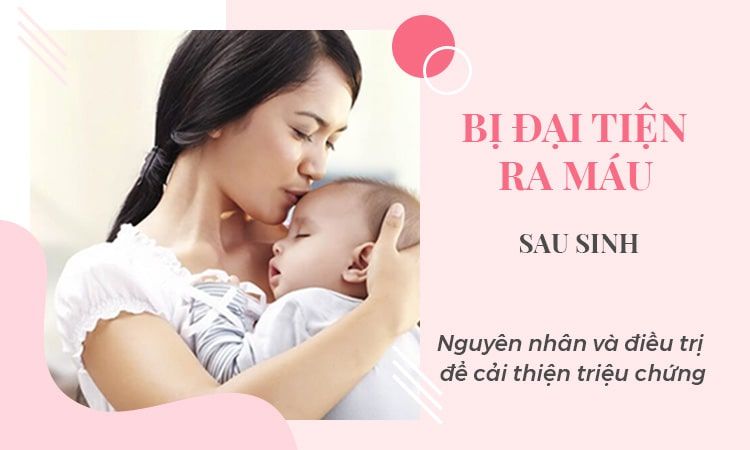 Sau sinh đi đại tiện ra máu: Nguyên nhân và biện pháp giải quyết