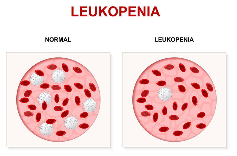 Số lượng bạch cầu giảm đáng kể: Những thông tin cần biết