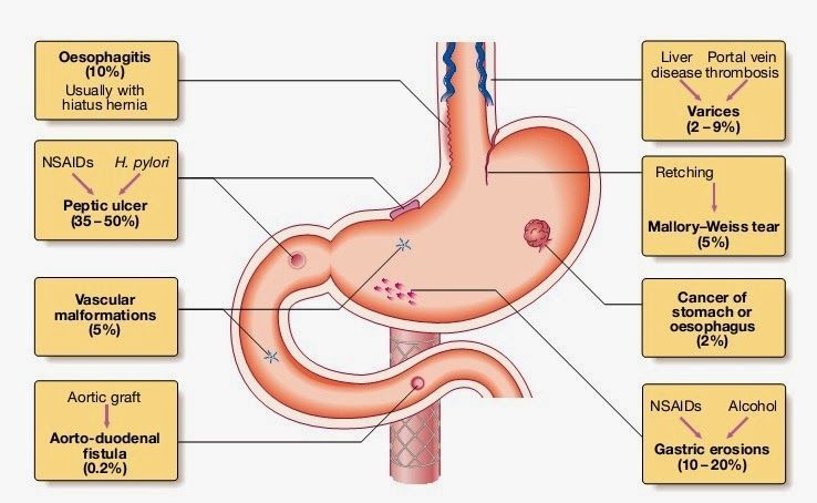 Sốt xuất huyết đường ruột: Nguyên nhân, triệu chứng và cách phòng tránh