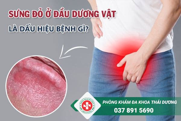 Sưng đầu dương vật - Nguyên nhân, triệu chứng và cách xử lý