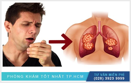 Tại sao ho hoài không hết? Nguyên nhân và cách khắc phục hiệu quả