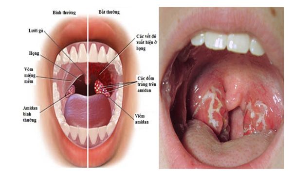 Tại sao lại nứng? Những nguyên nhân và cách giải quyết