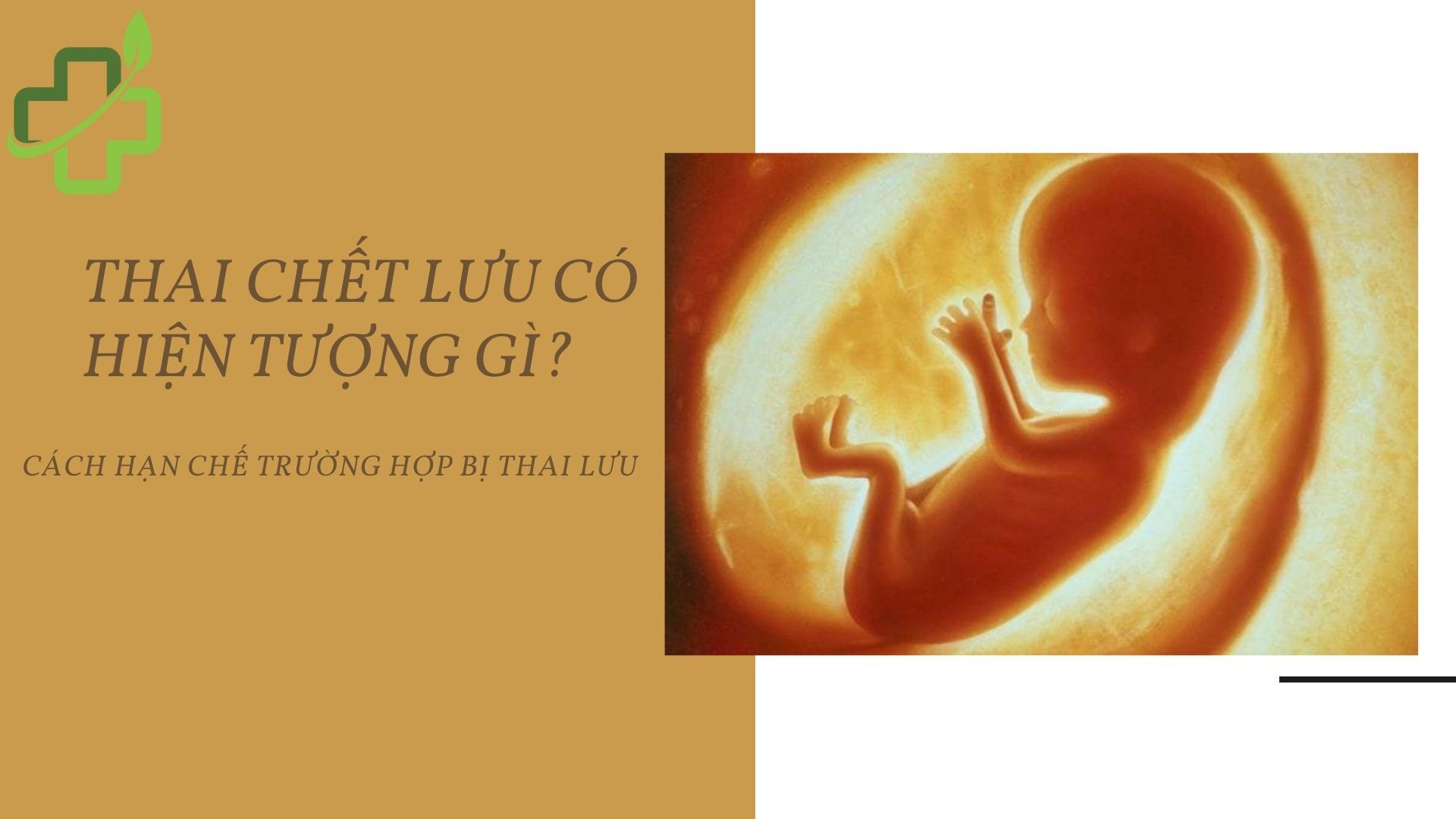 Thai lưu có hiện tượng gì - Tất cả những gì bạn cần biết về hiện tượng thai lưu