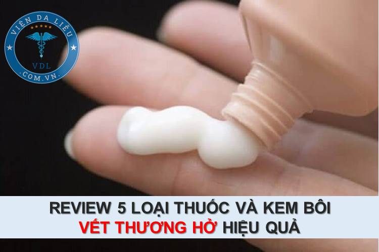 Thuốc bôi vết thương - Thông tin và cách sử dụng hiệu quả