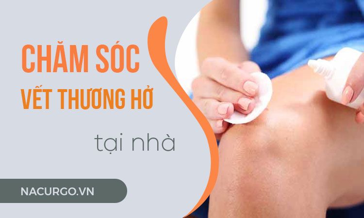 Thuốc bột rắc vết thương hở - Tất tần tật thông tin và cách sử dụng