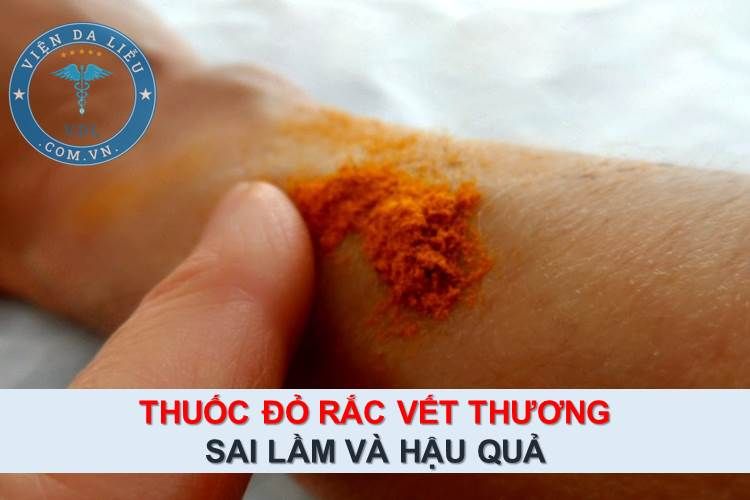 Tìm hiểu thông tin về thuốc rắc vết thương hở