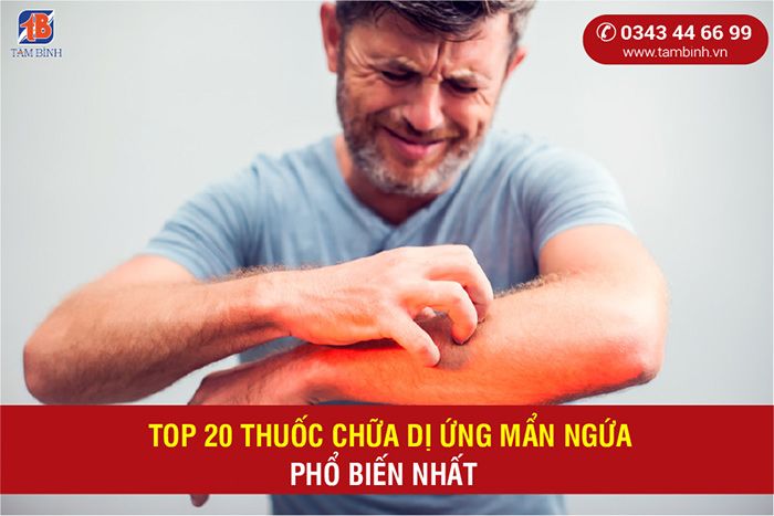 Tìm hiểu về thuốc trị viêm da dị ứng hiệu quả