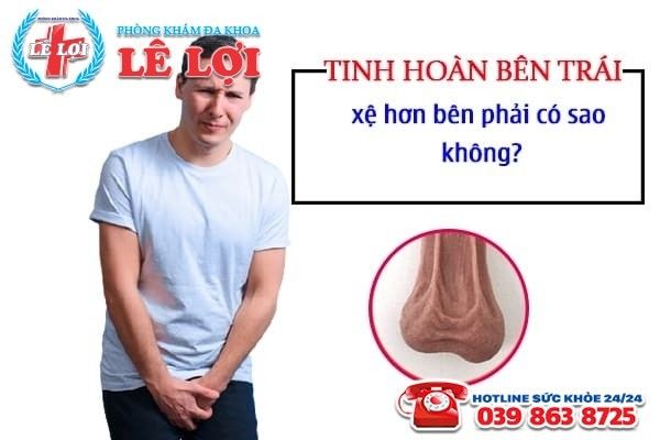 Tinh hoàn trái bị xệ - Nguyên nhân, triệu chứng và cách chữa trị