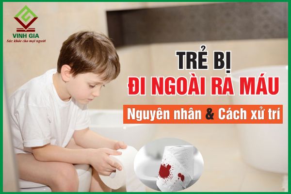 Tìm hiểu nguyên nhân và cách điều trị trẻ bị đi ngoài ra máu