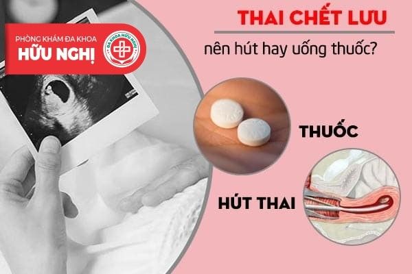 Uống thuốc gì để chấm dứt thai lưu? Tất cả những gì bạn cần biết