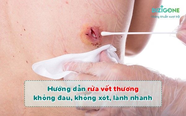 Cách vệ sinh vết thương hiệu quả - Những điều cần biết