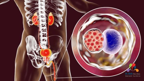 Tìm hiểu về virus chlamydia là gì